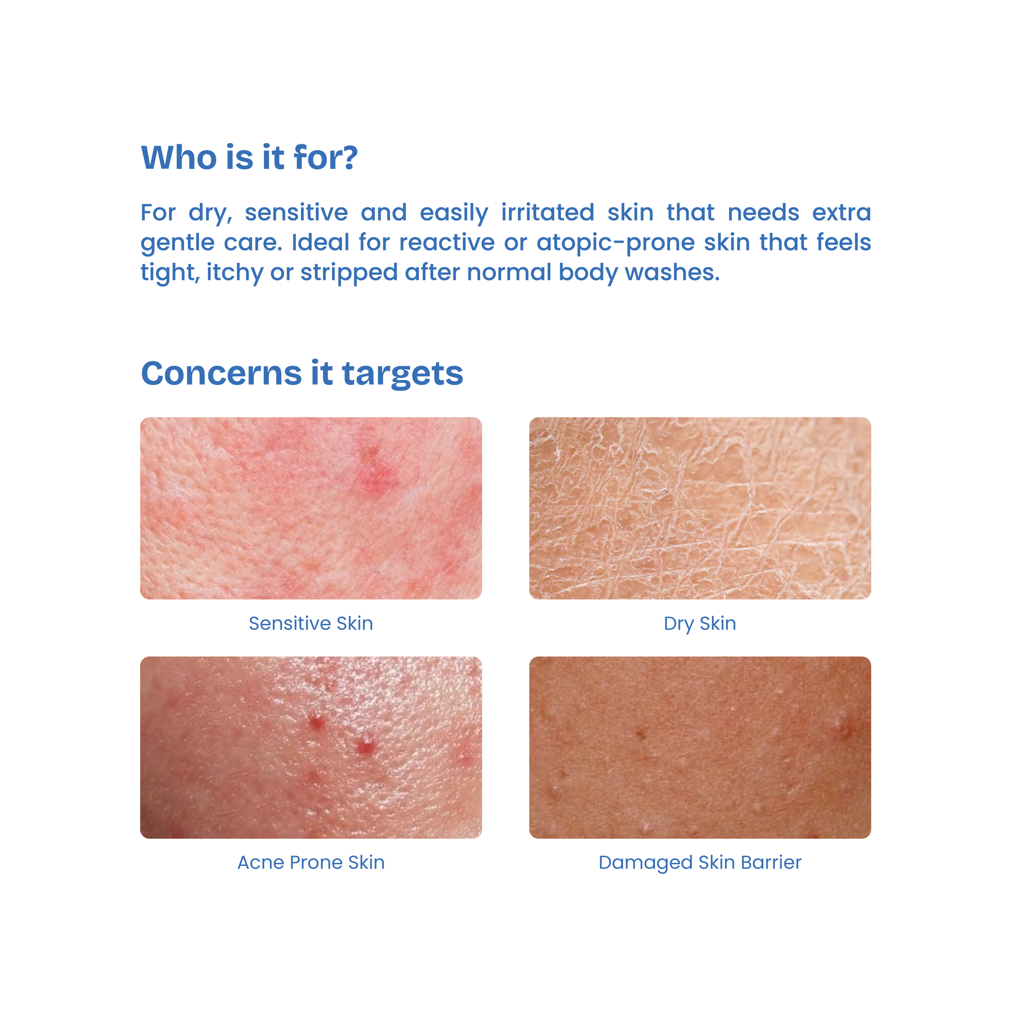 Product description for skin care solution targeting sensitive, dry, acne-prone, and damaged skin barrier skin types.